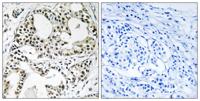 YEATS2 Polyclonal Antibody