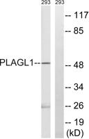 ZAC1 Polyclonal Antibody