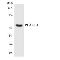 ZAC1 Polyclonal Antibody