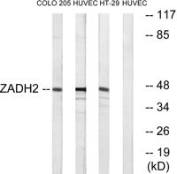 ZADH2 Polyclonal Antibody