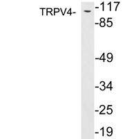 TRPV4 Polyclonal Antibody