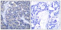 ZAP-70 Polyclonal Antibody