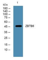 ZBTB6 Polyclonal Antibody