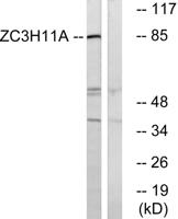 ZC3H11A Polyclonal Antibody