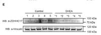 ZDH17 Polyclonal Antibody