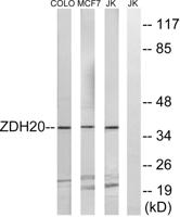 ZDHHC20 Polyclonal Antibody