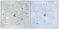 VHL Polyclonal Antibody