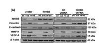 Vimentin Polyclonal Antibody