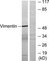 Vimentin Polyclonal Antibody