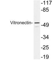 Vitronectin Polyclonal Antibody