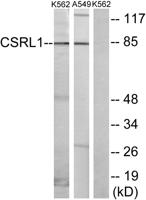 VN2R1P Polyclonal Antibody