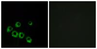 VPAC1 Polyclonal Antibody