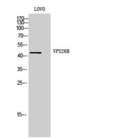 VPS26B Polyclonal Antibody