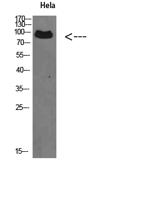 VPS35 Polyclonal Antibody