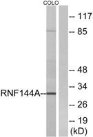 UBCE7IP4 Polyclonal Antibody