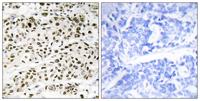 VPS72 Polyclonal Antibody