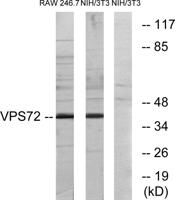 VPS72 Polyclonal Antibody