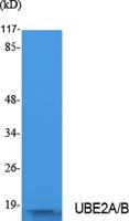 UBE2A/B Polyclonal Antibody