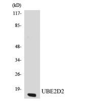 UBE2D2 Polyclonal Antibody