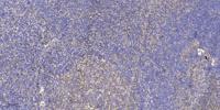 UBE2G1 Polyclonal Antibody