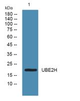 UBE2H Polyclonal Antibody