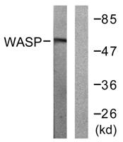 WASP Polyclonal Antibody