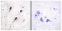 WAVE1 Polyclonal Antibody