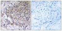 WAVE3 Polyclonal Antibody