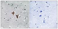 WAVE4 Polyclonal Antibody