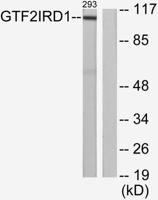 WBSCR11 Polyclonal Antibody