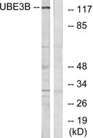 UBE3B Polyclonal Antibody