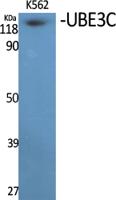 UBE3C Polyclonal Antibody