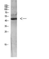 WISP-3 Polyclonal Antibody