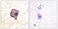 Ret Polyclonal Antibody