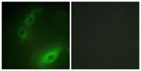 FoxO1A Polyclonal Antibody