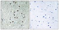 REXO1 Polyclonal Antibody