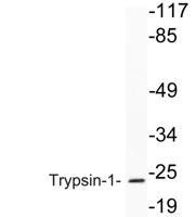 Trypsin-1 Polyclonal Antibody