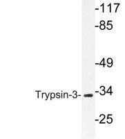 Trypsin-3 Polyclonal Antibody