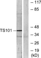 Tsg 101 Polyclonal Antibody