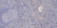 TSG-6 Polyclonal Antibody