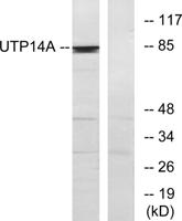 UTP14A Polyclonal Antibody