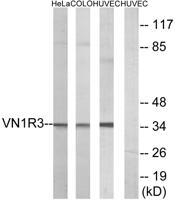 V1RL3 Polyclonal Antibody