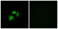 V1RL5 Polyclonal Antibody