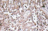 VAMP-1/2/3 Polyclonal Antibody