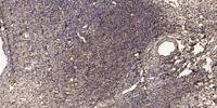 VASP Polyclonal Antibody