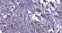 VASP Polyclonal Antibody