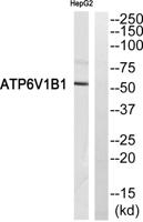 V-ATPase B1 Polyclonal Antibody