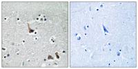 V-ATPase H Polyclonal Antibody