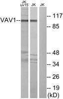 Vav1 Polyclonal Antibody