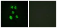 VAV1 Polyclonal Antibody